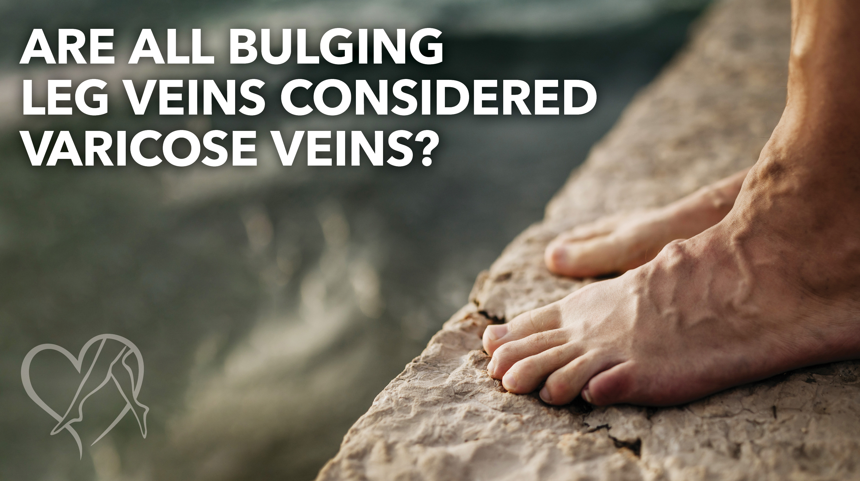Blog Image Are All Bulging Veins Varicose Veins Thumbnail