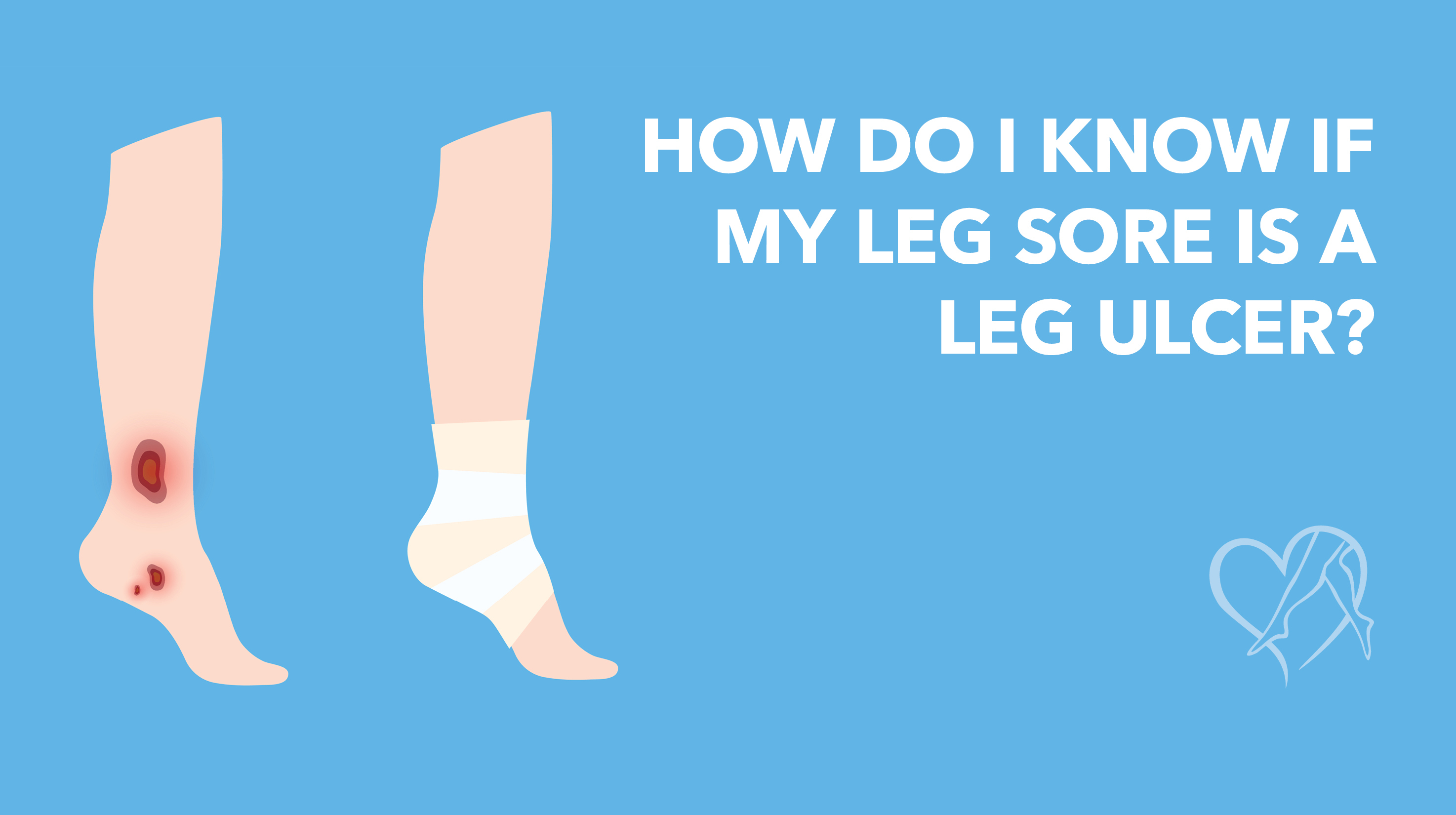 Blog How Do I Know If Leg Sore Is Ulcer THUMBNAIL