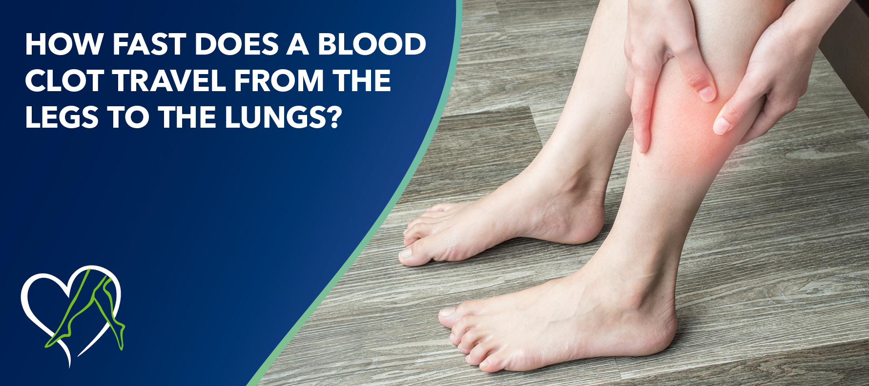 How Fast Does a Blood Clot Travel from the Legs to the Lungs?