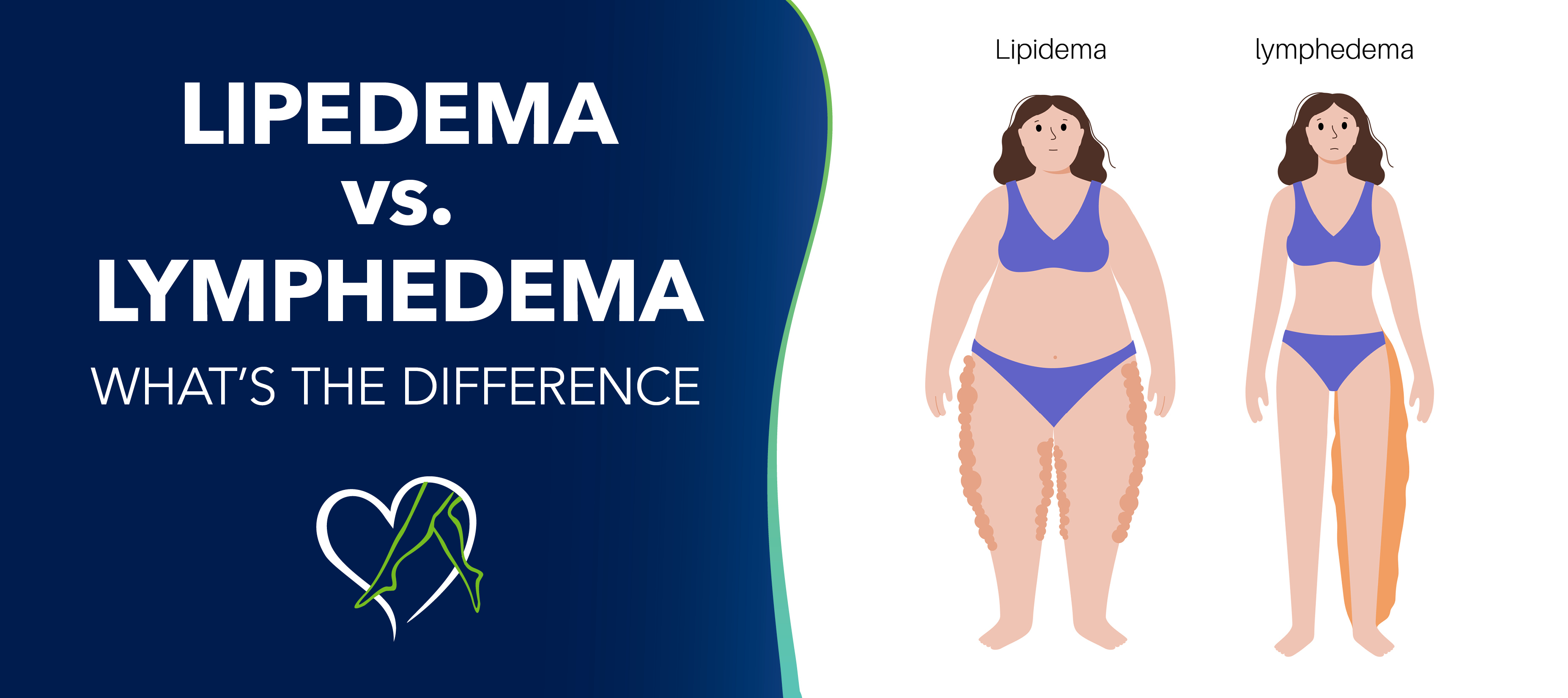 What Makes Lipedema Care So Expensive?