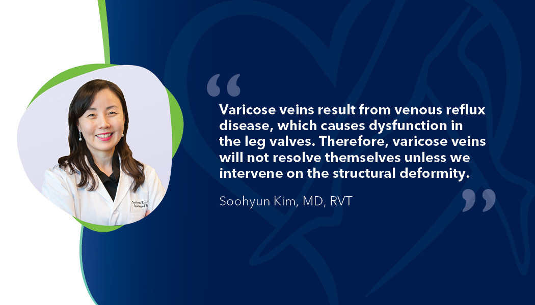 Blog Quote Dr Soo Kim Can Varicose Veins Go Away On Their Own