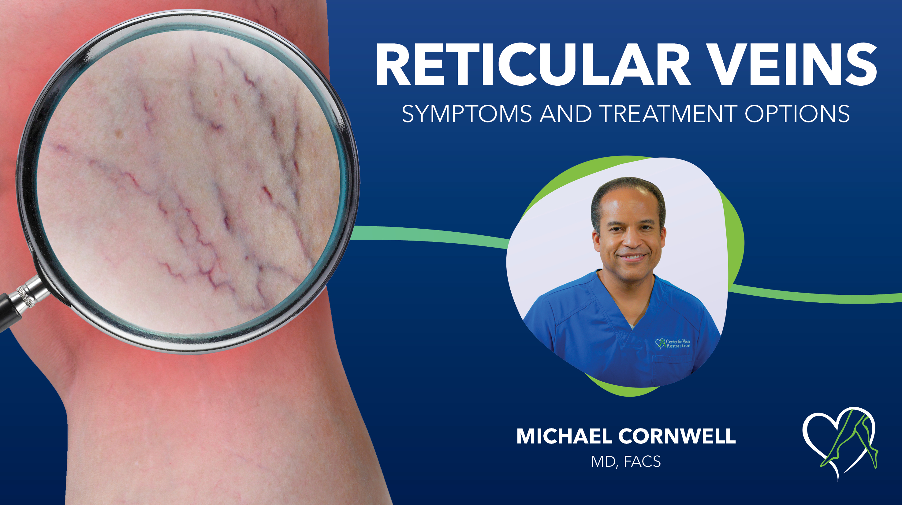 Blog Reticular Veins Thumbnail