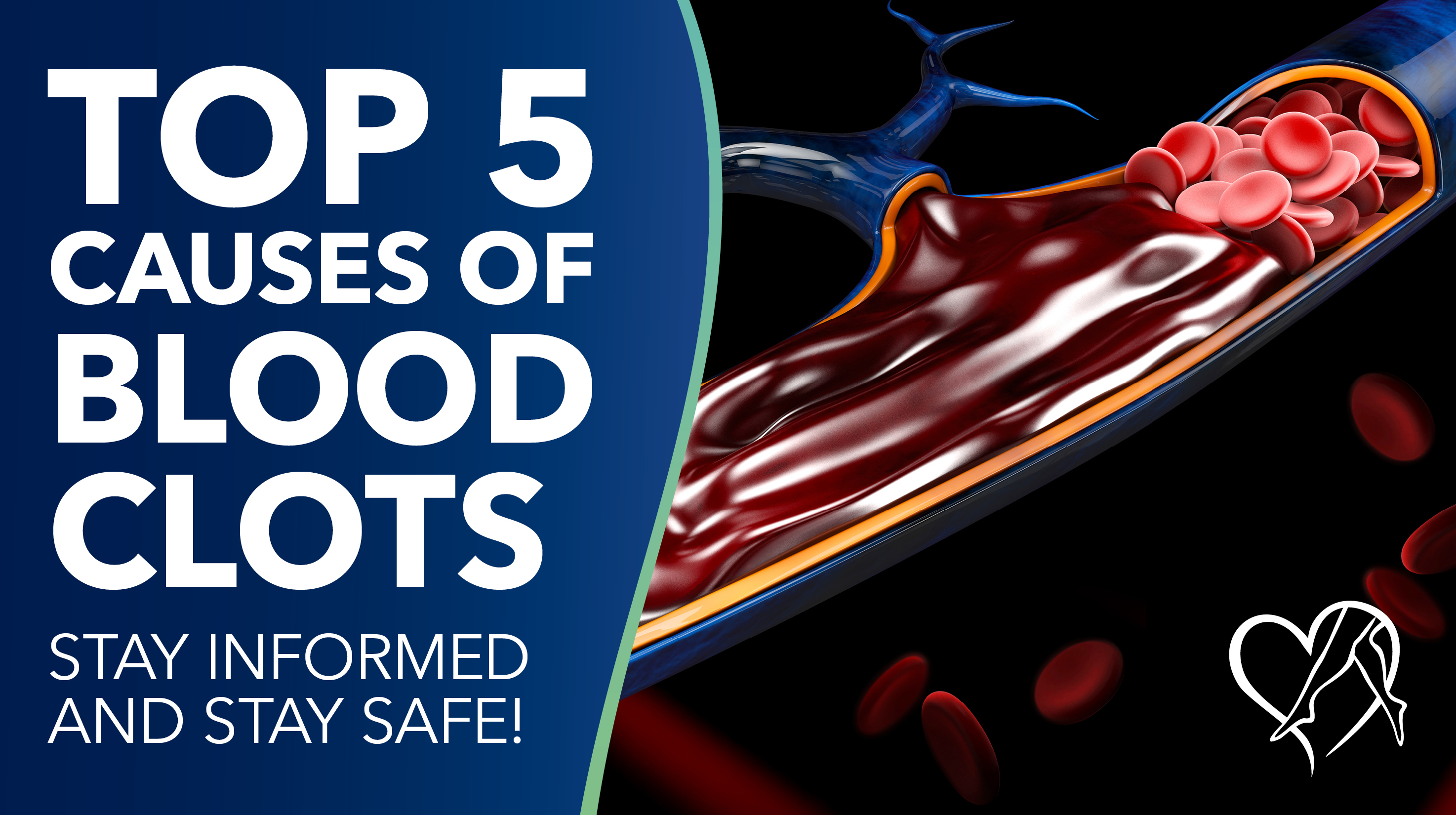 Blog Top5 Causes Of Blood Clots Thumbanail