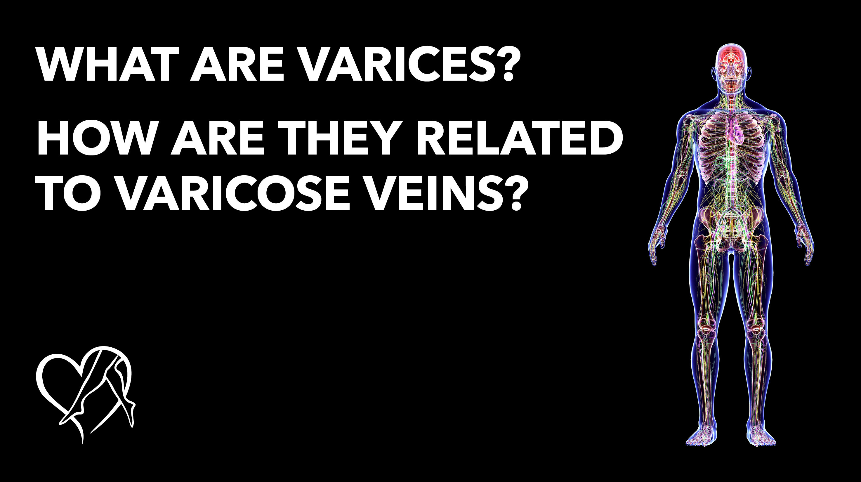 Blog What Are Varices Thumbnail