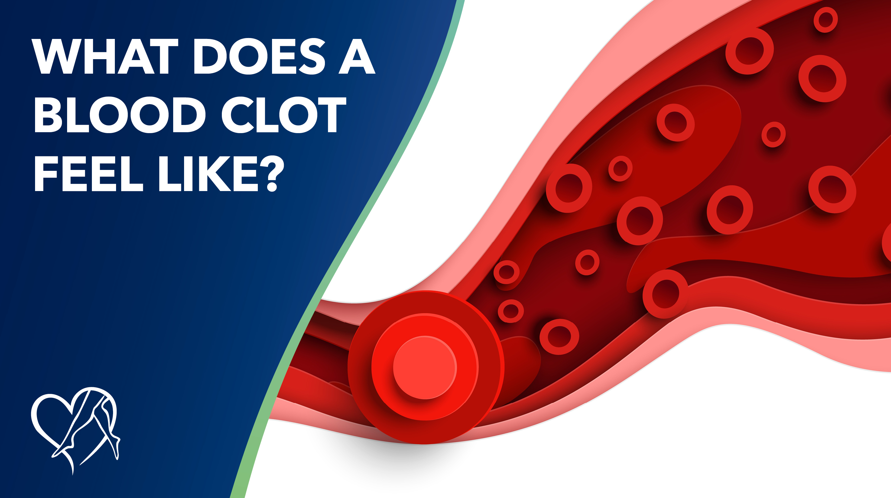 Blog What Does A Blood Clot Feel Like Thumbnail