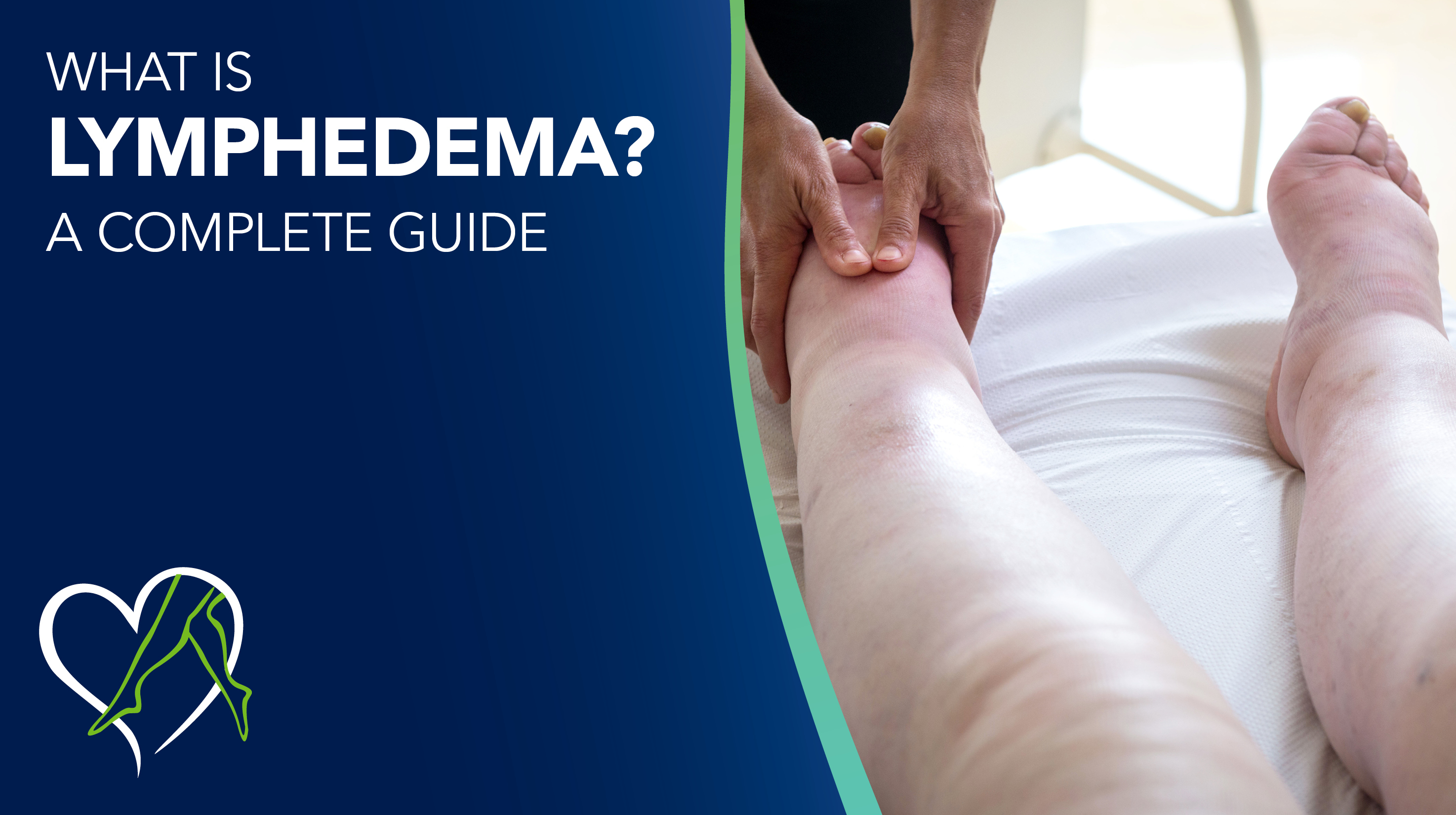 Blog What Is Lymphedema THUMBNAIL