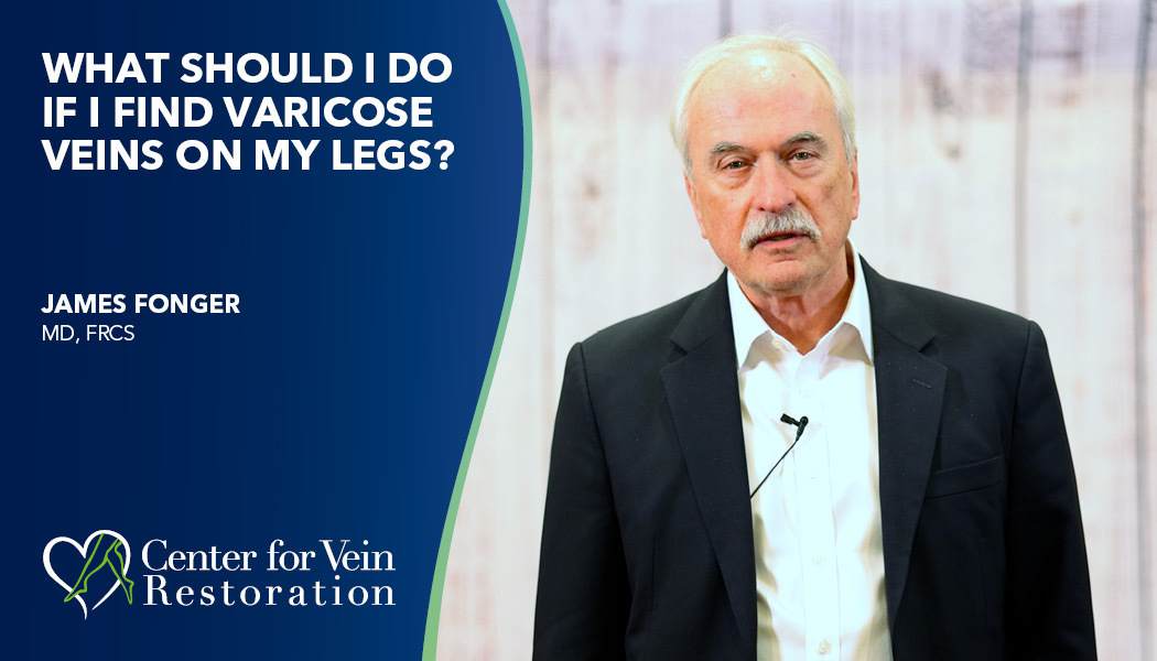 Blog What Should I do if I Find Varicose veins On My Legs
