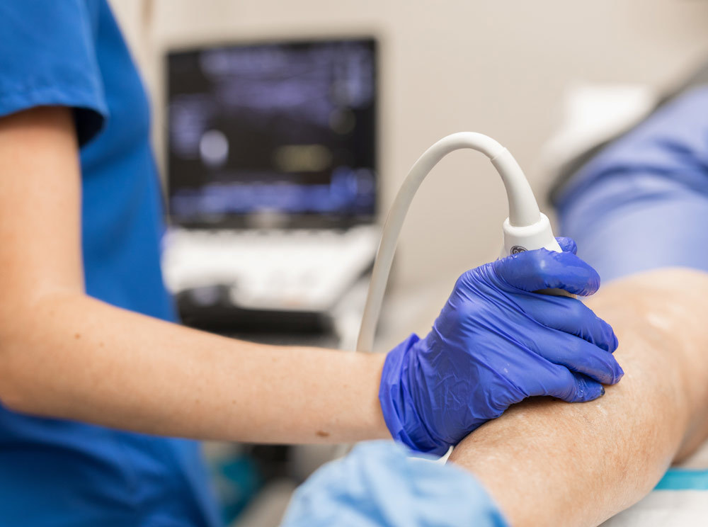 CVR Hand during Ultrasound