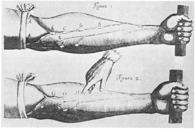 William Harvey 1578 1657 Venenbild vein treatment