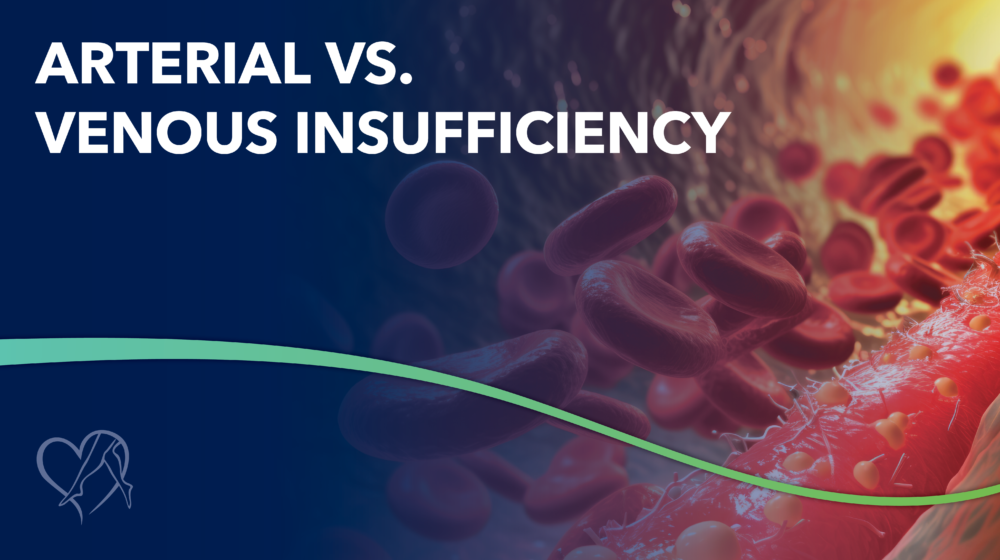 Blog Arterialvs Venous Insufficiency thumbnail