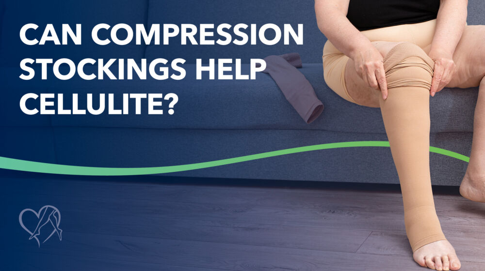 Blog Can Compression Stockings Help Cellulite Thumbnail