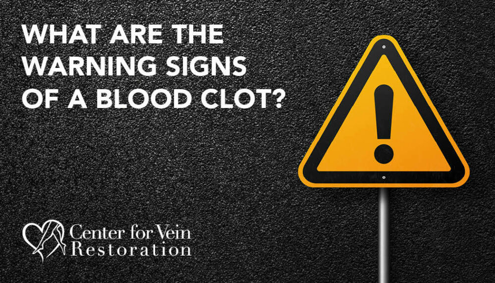 Blog What Are The Warning Signs Blood Clot