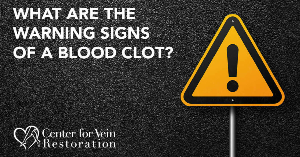 What Are the Warning Signs of a Blood Clot?
