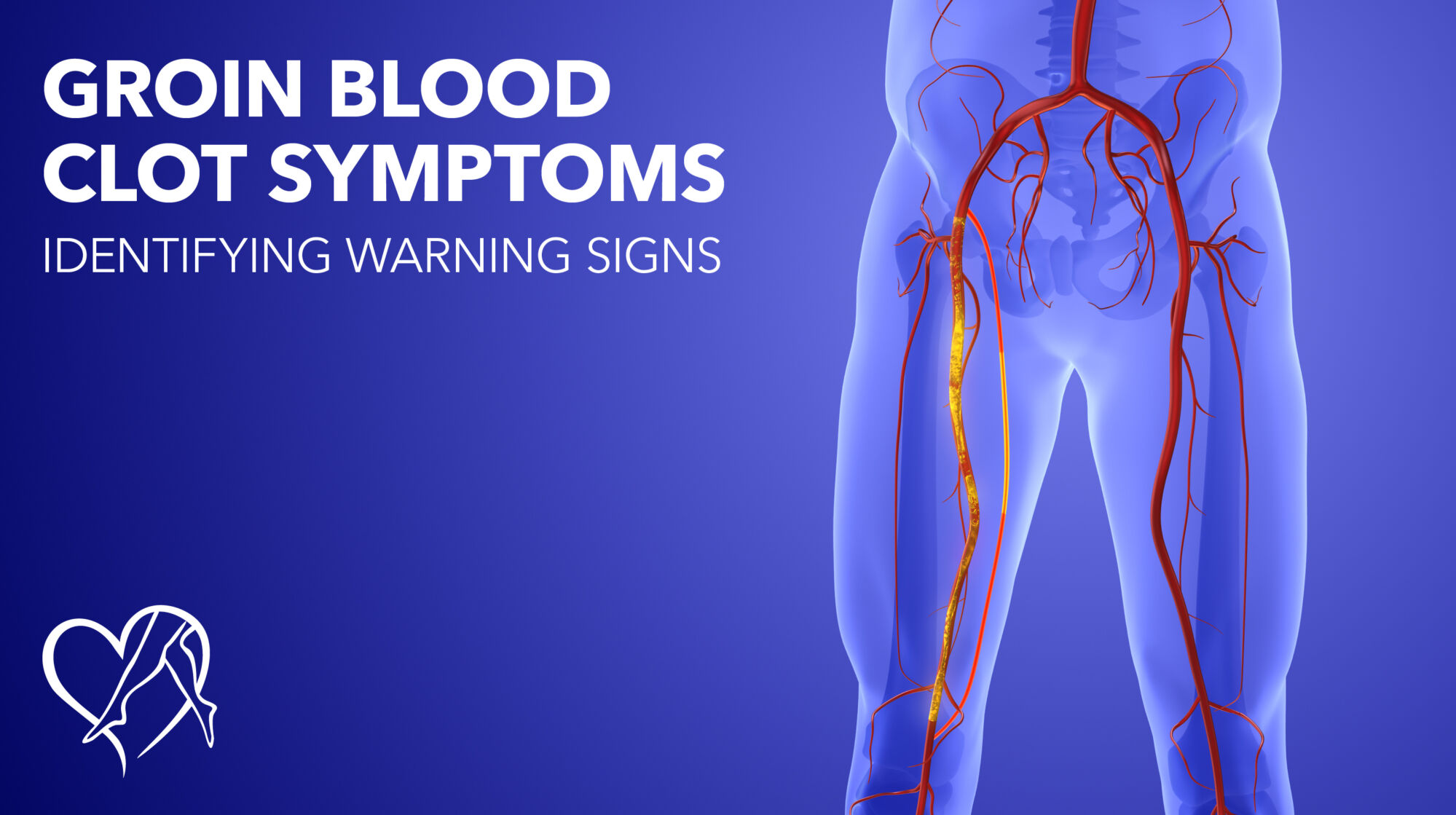 Blog Image Groin Blood Clot Symptoms Thumbnail