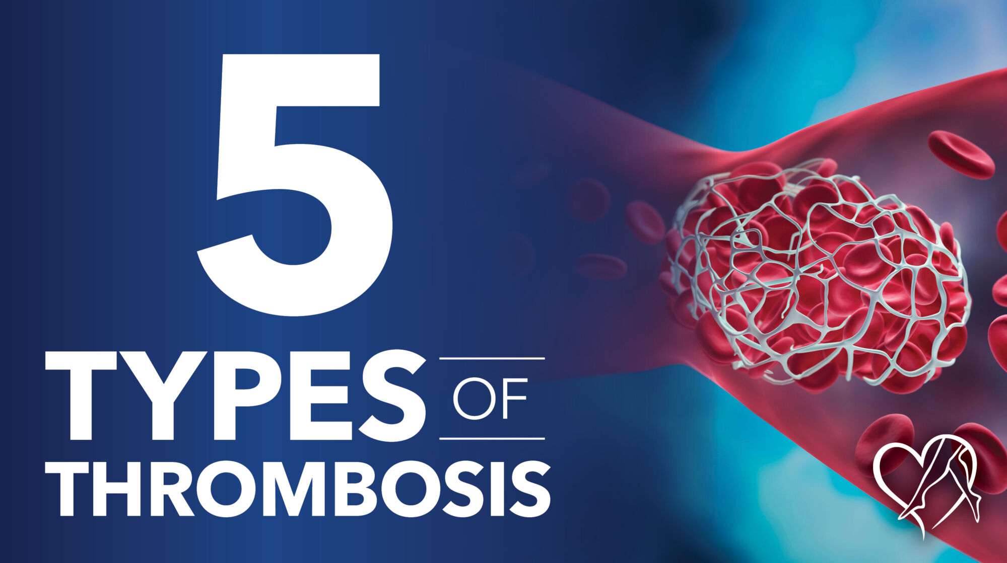 Blog 5 Types of Thrombosis Thumbnail