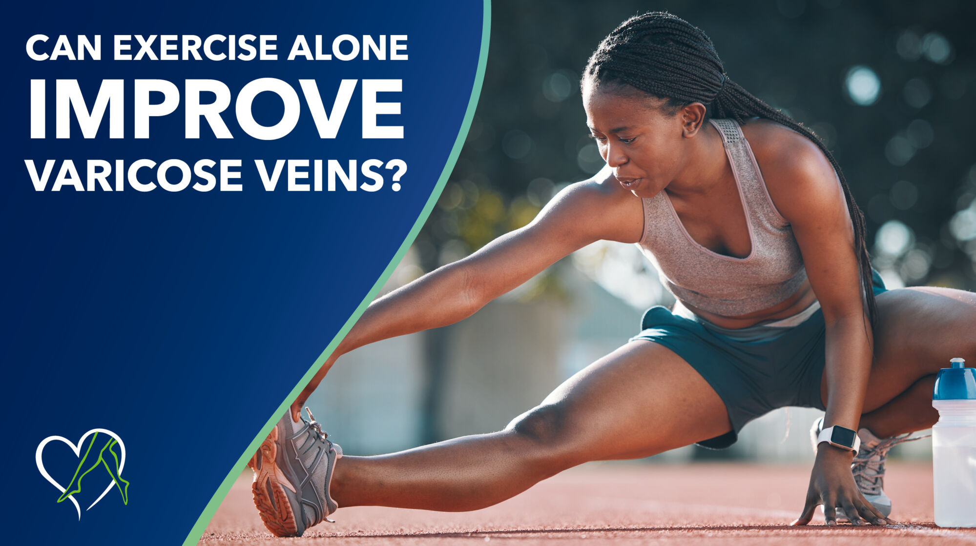 Blog Can Exercise Alone Improve Varicose Veins Thumbnail