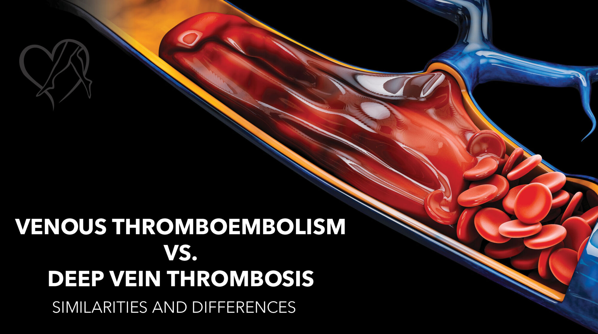 Venous Thromboembolism vs DVT BLOG THUMBNAIL