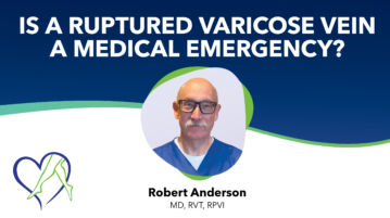 Blog Image Dr Anderson Ruptured Varicose Vein Thumbnail