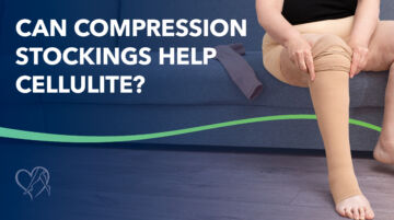Blog Can Compression Stockings Help Cellulite Thumbnail