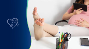 Blog Varicose Veins During Pregnancy Thumbnail