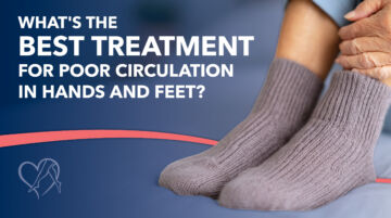 Blog Whats the Best Treatment for Poor Circulation in Hands and Feet Thumbnail
