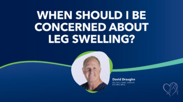 Blog When Should I Be Concerned With Leg Swelling Thumbnail