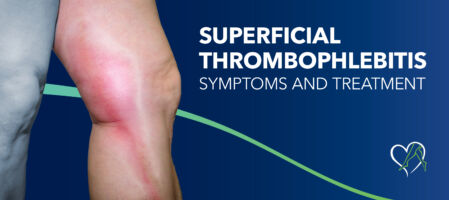 Blog Image Superficial Thrombophlebitis