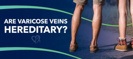 Blog Image Are Varicose Veins Hereditary