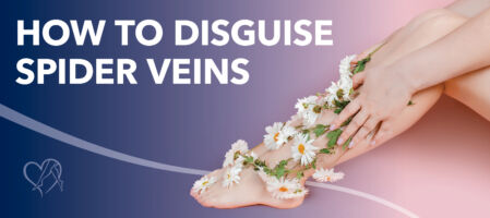 Blog How To Disguise Spider Veins