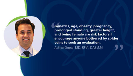 Blog Quote Dr Gupta What Are Spider Veins 040623