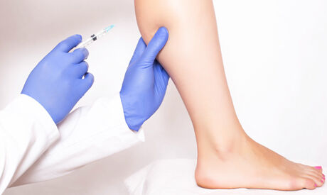 Can i use botox to get rid of varicose veins thumbnail