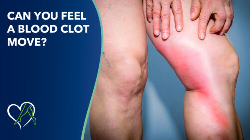 Blog I Mage Can You Feel Bloot Clot Move Thumbnail
