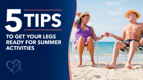 Blog Image 5 Tipsto Get Your Legs Readyfor Summer Activities Thumbnail