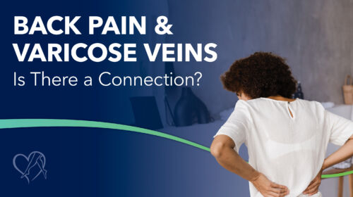 Blog Image Back Pain And Varicose Veins Is There A Connection Thumbnail