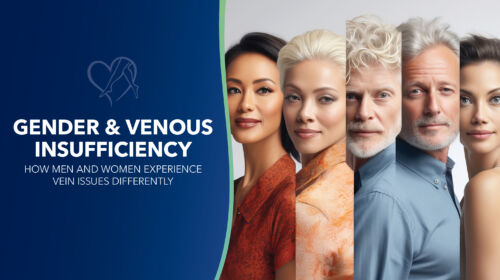 Blog Image How Men Women Experience Vein Issues Differently Thumbnail