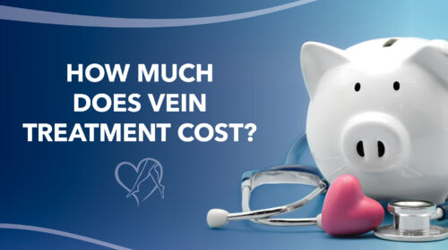 Blog Image How Much Does Vein Treatment Cost Thumbnail