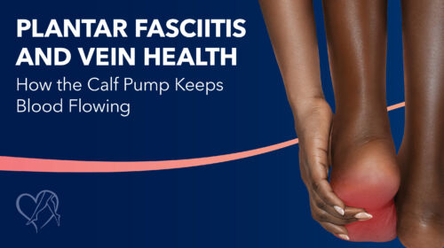 Blog Image Plantar Fasciitis Thumbnail