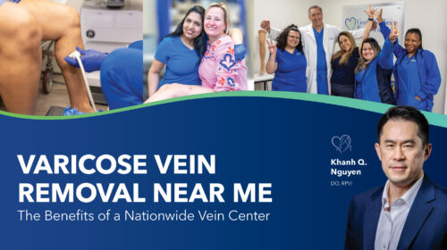 Blog Image Varicose Vein Removal Near Me Thumbnail