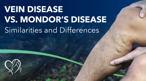 Blog Image Vein Disease VS Mondors Disease Thumbnail