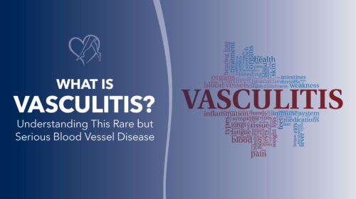 Blog Image What Is Vasculitis Thumbnail