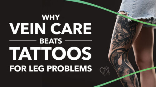 Blog Image Why Vein Care Beats Tattoosfor Leg Problems Thumbnail