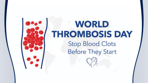 Blog Image World Thrombosis Day Stop Blood Clots Thumbnail