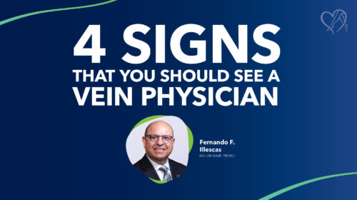 Blog 4 Signs You Should See A Vein Physician Thumbnail