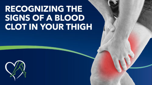 Blog Blood Clot Thigh Thumbnail