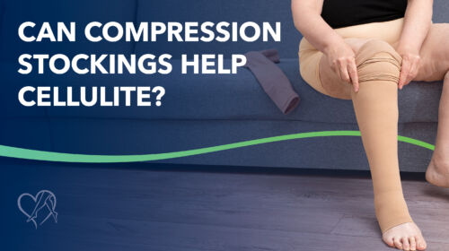 Blog Can Compression Stockings Help Cellulite Thumbnail
