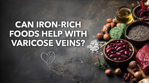 Blog Can Iron Rich Foods Help With Varicose Veins Thumbnail