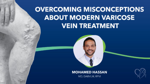 Blog Dr Hassasn Overcoming Misconceptions About Modern Varicose Vein Treatment Thumbnail