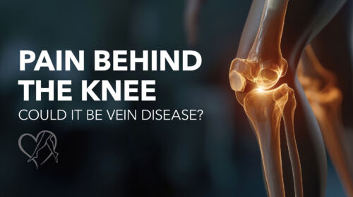 Blog Pain Behind The Knee Thumbnail