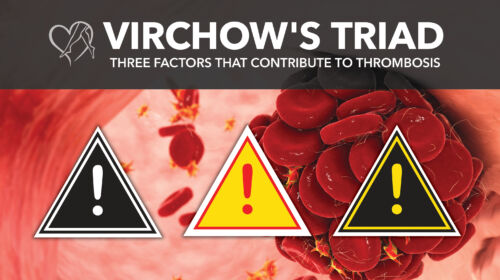 Blog Virchows Triad Thumbnail
