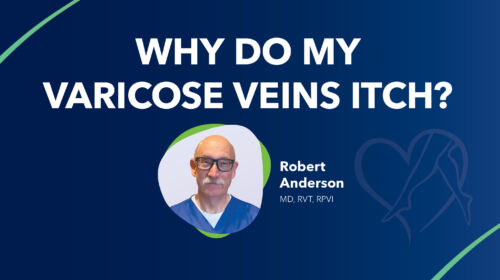 Blog Why Do My Varicose Veins Itch Anderson Thumbnail